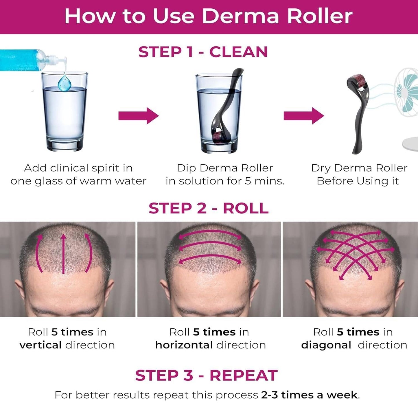 Derma Roller System โ Boost Hair Growth & Restore Confidence ๐ฟ