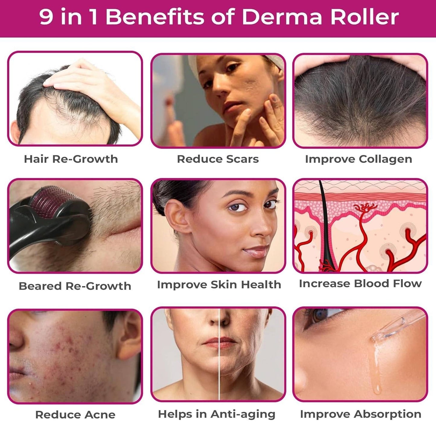 Derma Roller System โ Boost Hair Growth & Restore Confidence ๐ฟ