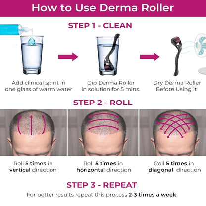 Derma Roller System – Boost Hair Growth & Restore Confidence 🌿